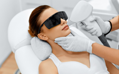 CO 2 RE Laser