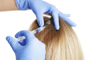 Hair Loss: Tips for Managing