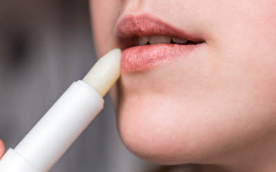 How To Prevent And Treat Dry, Chapped Lips