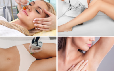 Preparing For Laser Hair Removal