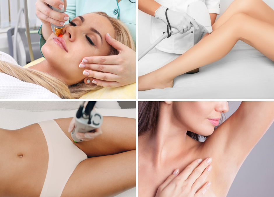 Preparing For Laser Hair Removal