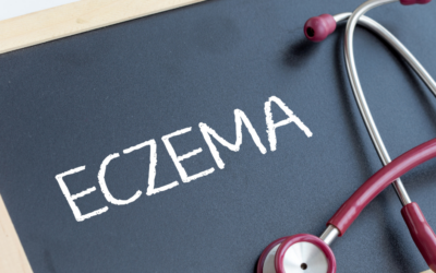 Should a child who has eczema see a dermatologist?