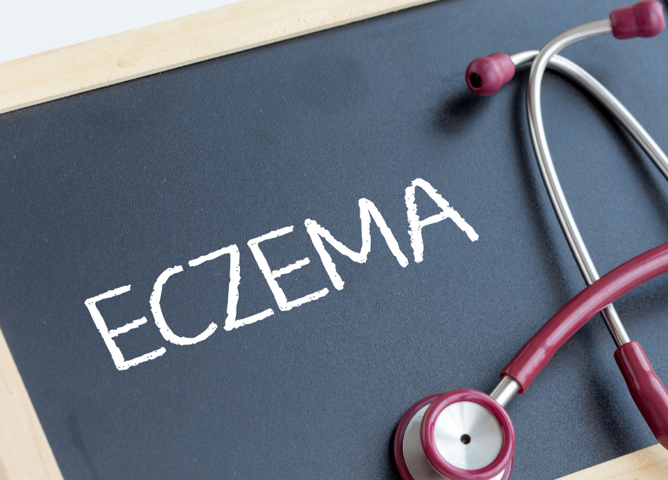 Eczema