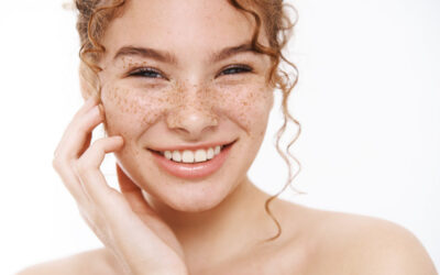 Moles vs. Freckles: What’s the Difference?
