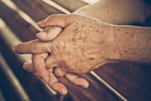 An overhead, close-up shot shows a pair of elderly hands with interlaced fingers resting on a wooden surface - https://wmderma.com/
