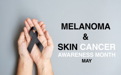 Melanoma Awareness Month – Why Should You Schedule A Yearly Skin Exam?