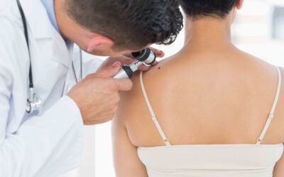 What to Expect at a Skin Exam