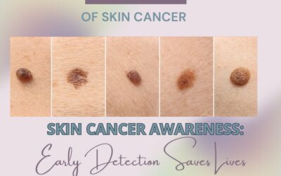 May is Skin Cancer Awareness Month: