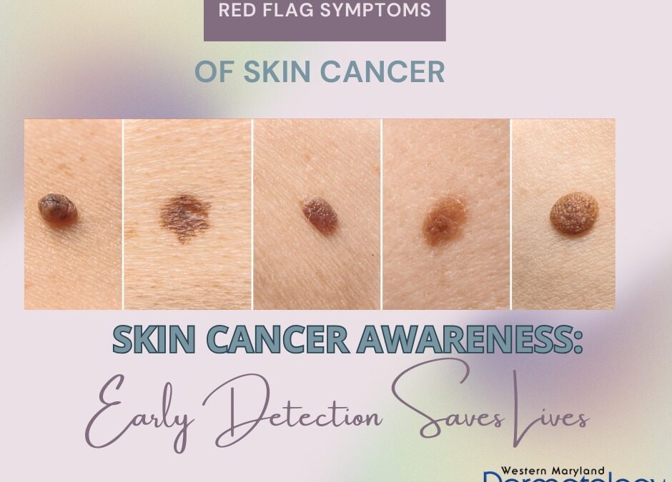 May is Skin Cancer Awareness Month: