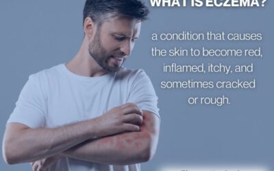 October is Eczema Awareness Month: Understanding and Managing Eczema